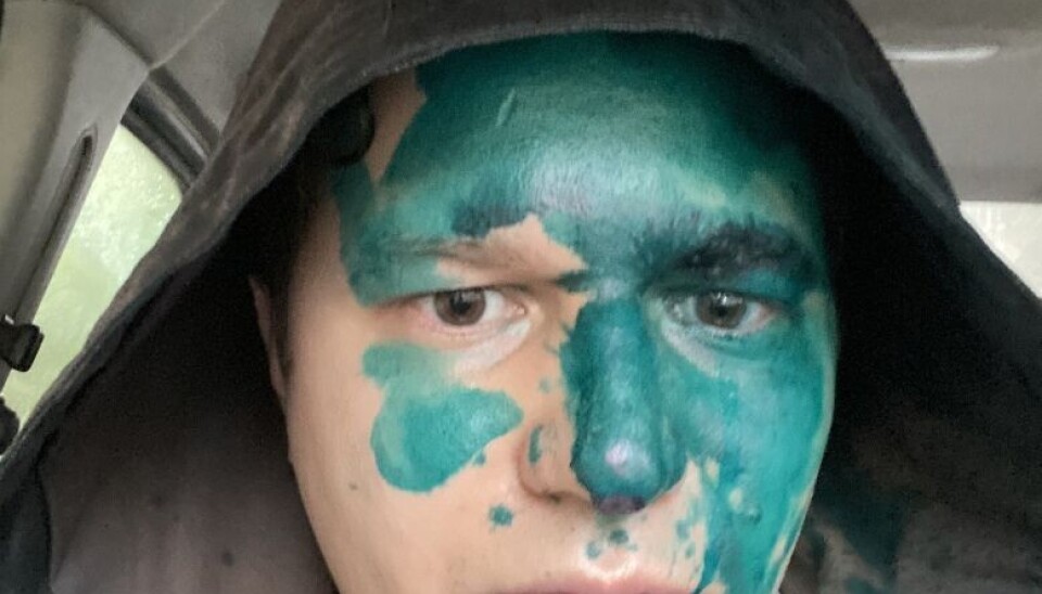 In September 2020, Viktor Vorobyov sued the territorial election commission in Syktyvkar when he was running for the State Council. When he was exiting from the court, he was doused with brilliant green. Vorobyov had to go to the hospital. Lawmakers from four regions then demanded that the attack be investigated. It took a month to initiate a criminal case, but then it was suspended “due to the failure to identify” the suspect. Photo from the politician’s social media profile page