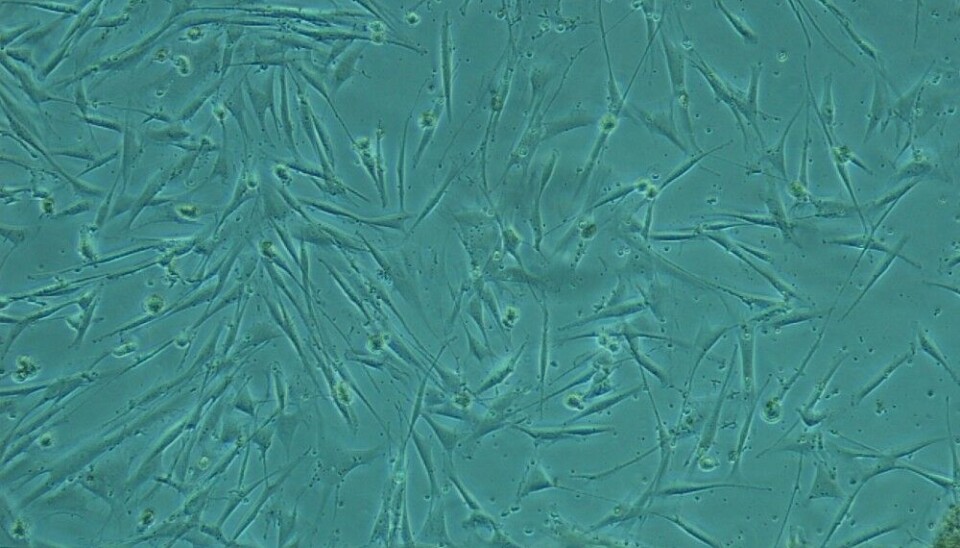 The fragment of killer whale tissue at the interface between skin and fat is used to establish cell cultures (the cells shown are fibroblasts). These cells will be further exposed to pollutants. Photo: Juni Bjørneset / Norwegian Polar Institute